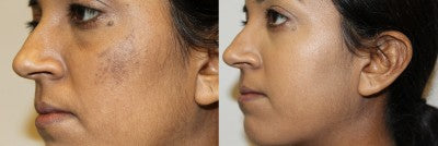 HOW TO LIGHTEN ASIAN SKIN IN 7 EASY STEPS