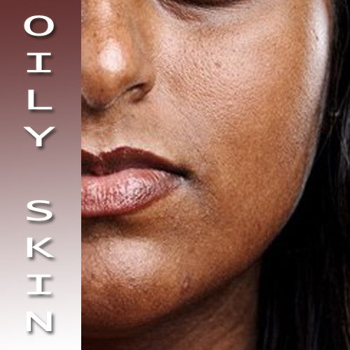 LIFESTYLE HABITS THAT MAY AFFECT OILY SKIN!