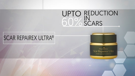TREATMENT FOR ACNE SCARS
