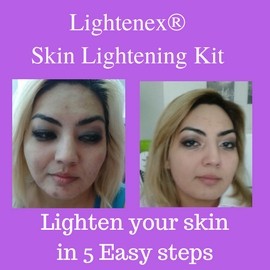 LIGHTENEX SKIN LIGHTENING KIT