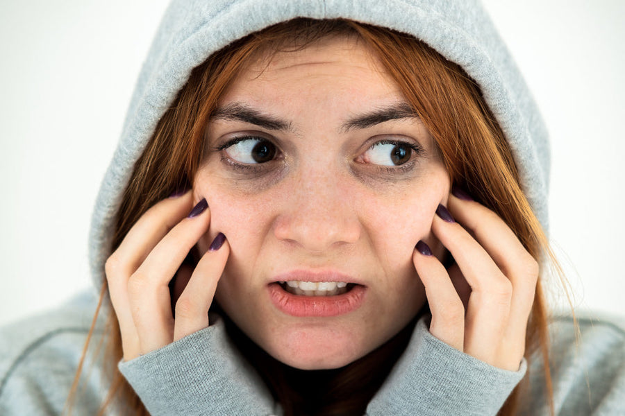 Hyperpigmentation Under Eyes: Causes, Treatment and Prevention