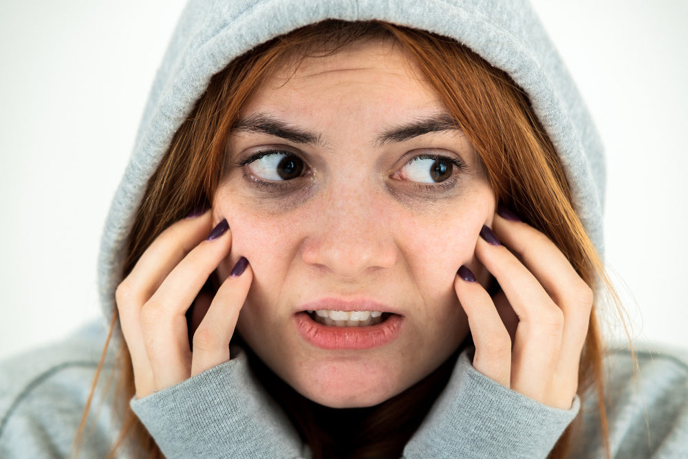 Hyperpigmentation Under Eyes: Causes, Treatment and Prevention