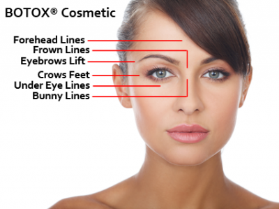WHAT IS BOTOX?