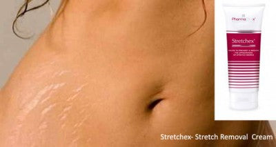IDENTIFYING SKINCARE THAT EFFECTIVELY TREATS STRETCH MARKS