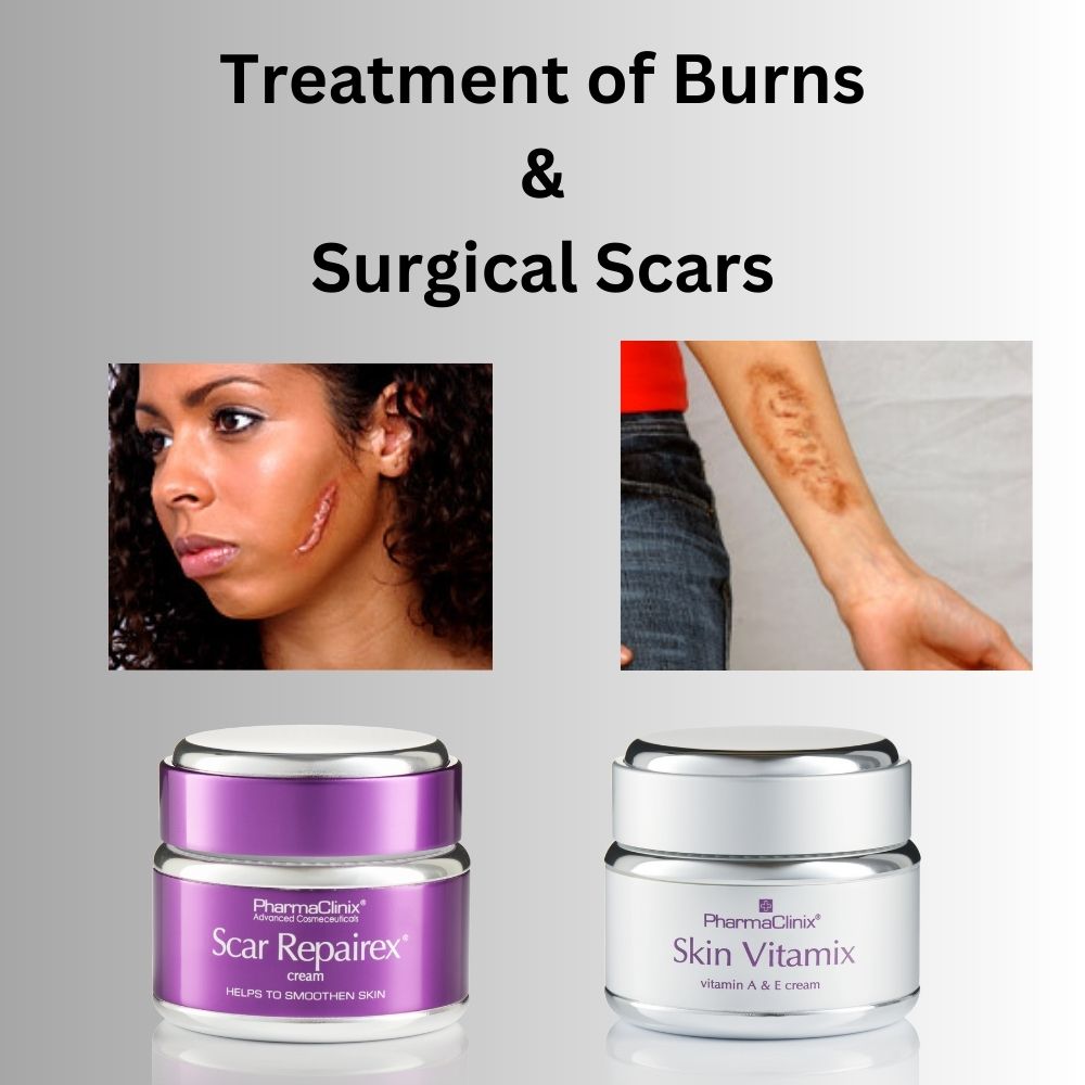 Treatment of Burns & Surgical Scars